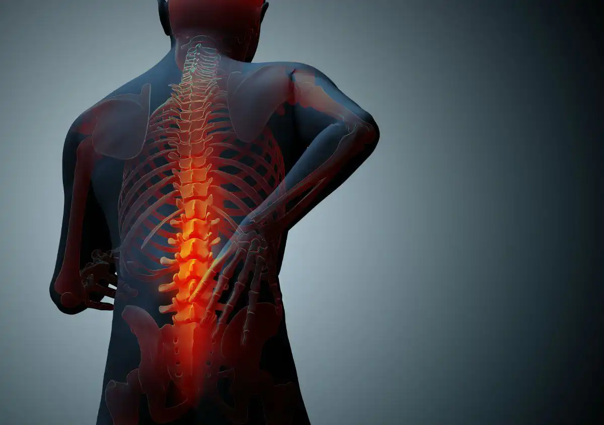 Worker with a back injury pursuing a Missouri workers’ compensation claim