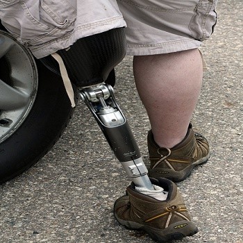 prosthetic-leg