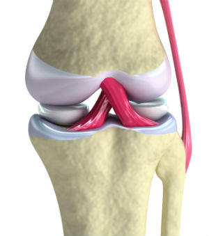 cartilage injury