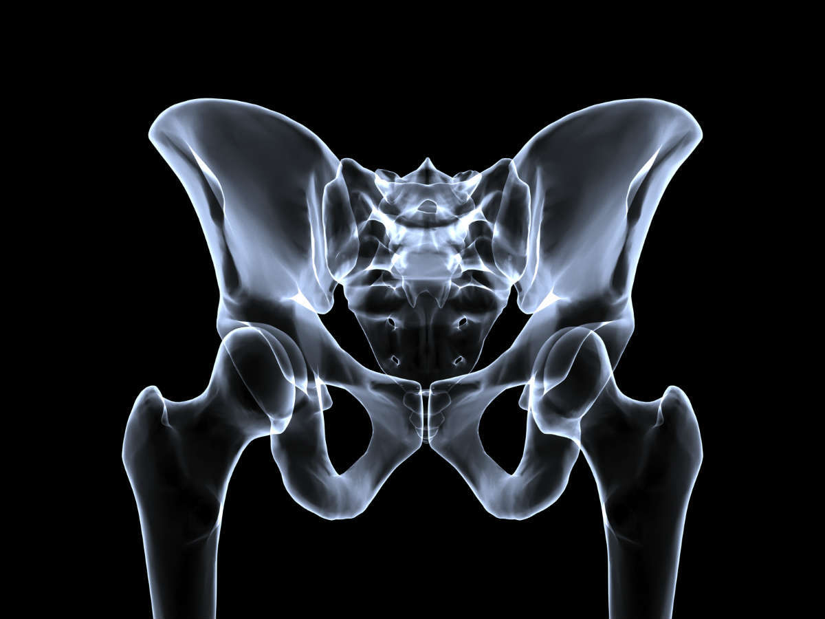 pelvic fracture lawyer