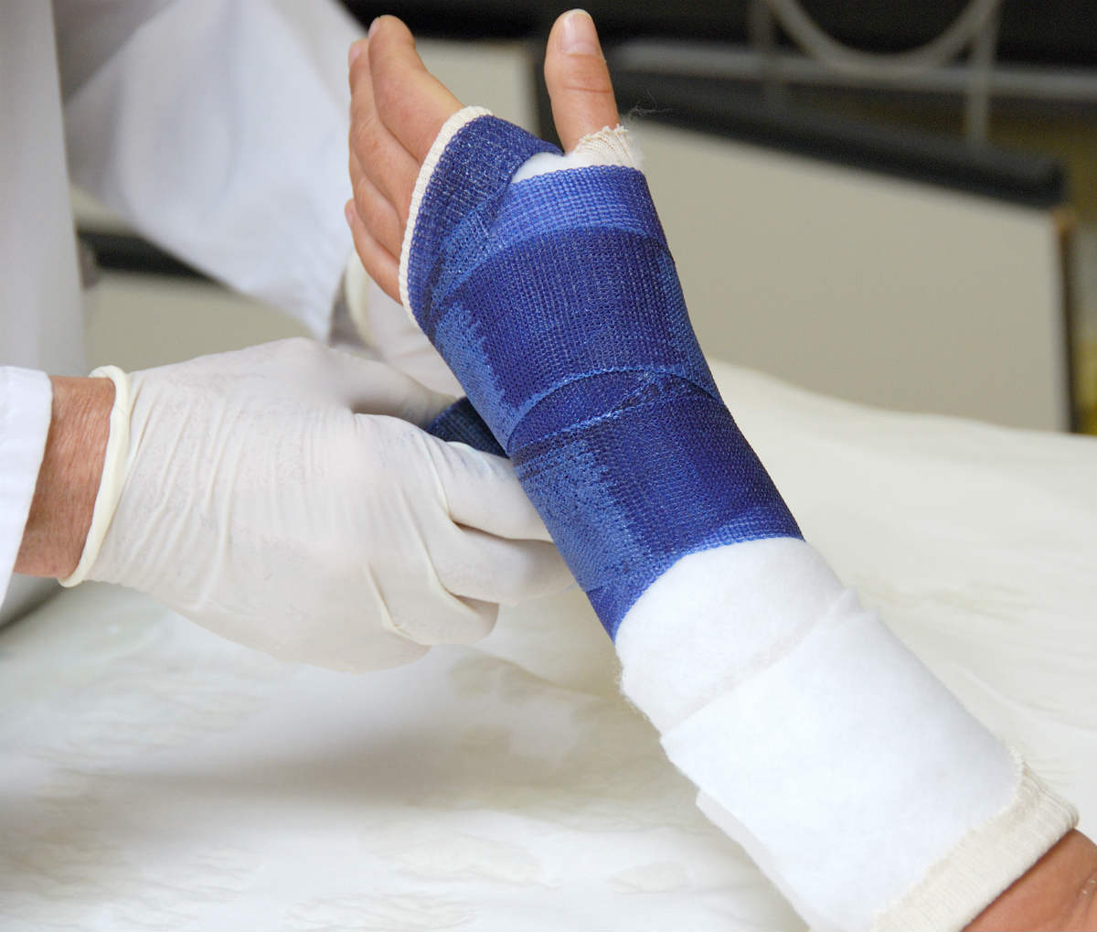 broken arm worker compensation