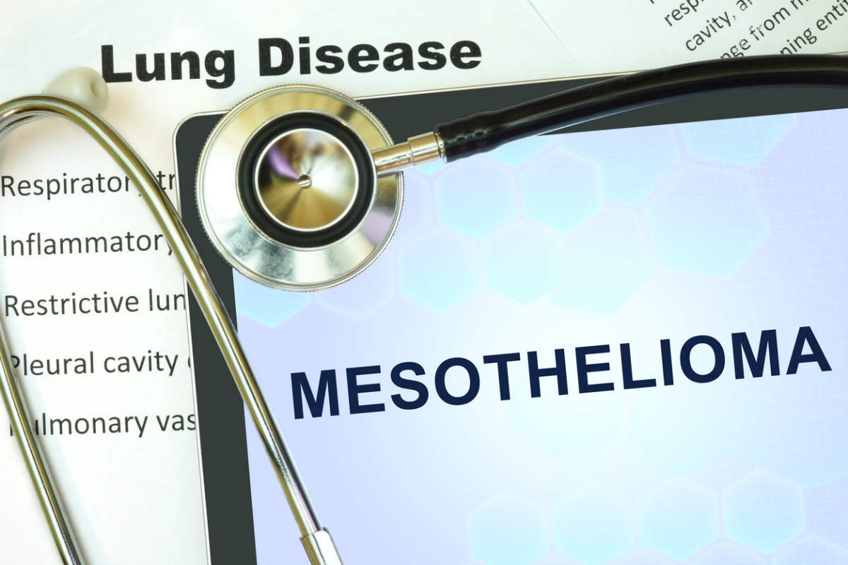 mesothelioma-diagnosis-st-louis