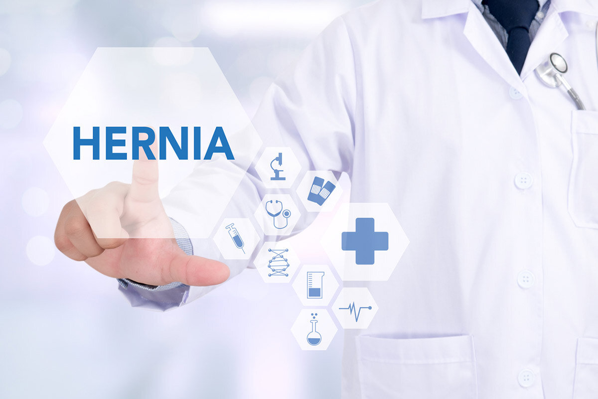 Hernia Workers Comp St. Louis