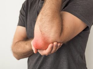 Missouri Workers Compensation Claims for-Bursitis Injuries