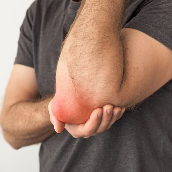 Missouri Workers Compensation Claims for-Bursitis Injuries