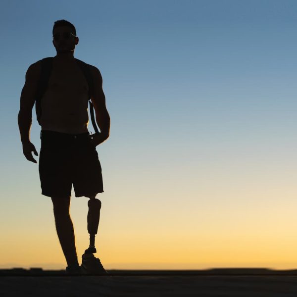 st. louis man with leg amputation