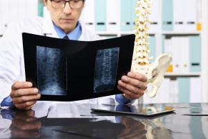 injury spinal lawsuit dismissed