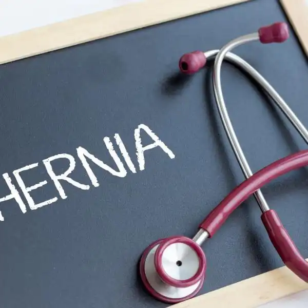 hernia