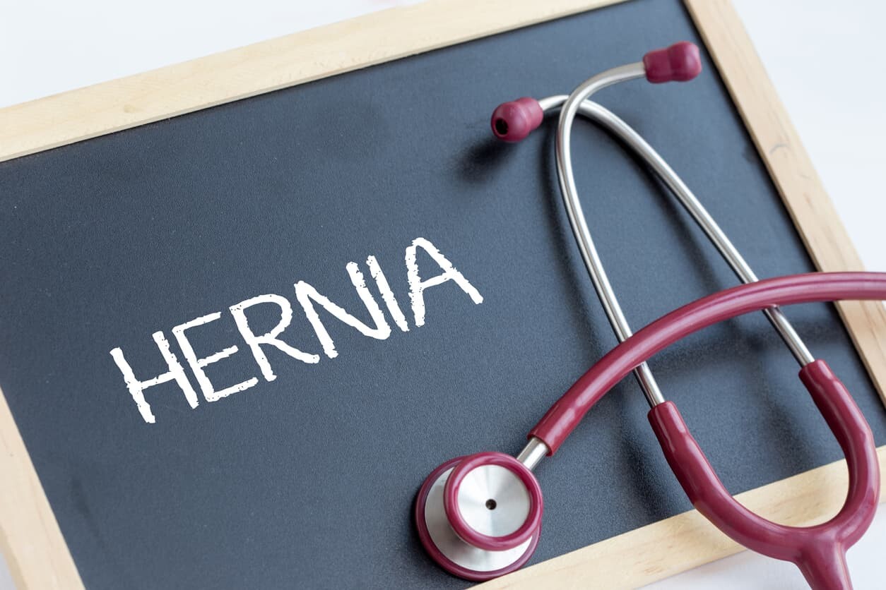 hernia